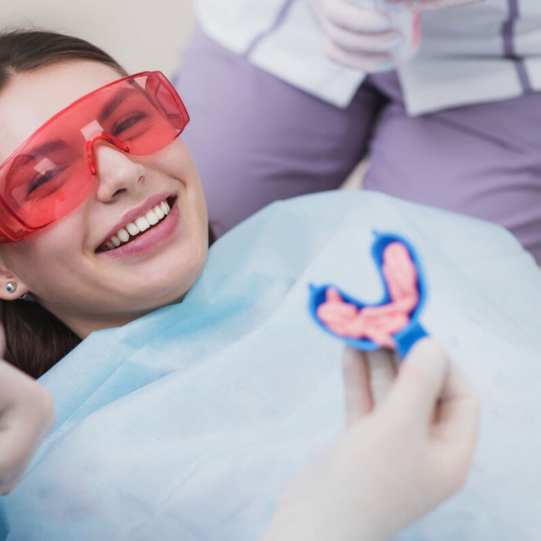 Image PLATEAU BUCCAL